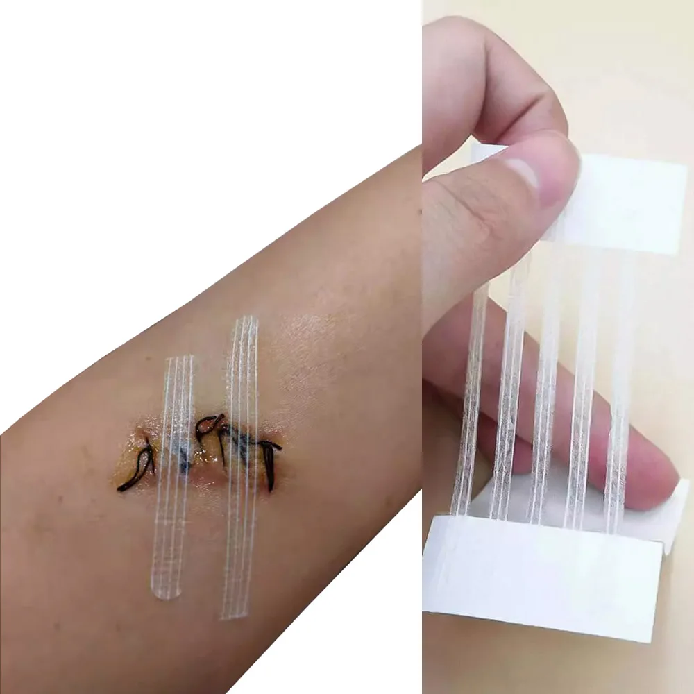 

Полоски для закрытия кожи ран, послеродовой ремонт ран, косметическая хирургия, клейкая лента без швов, защитная наклейка, крышка