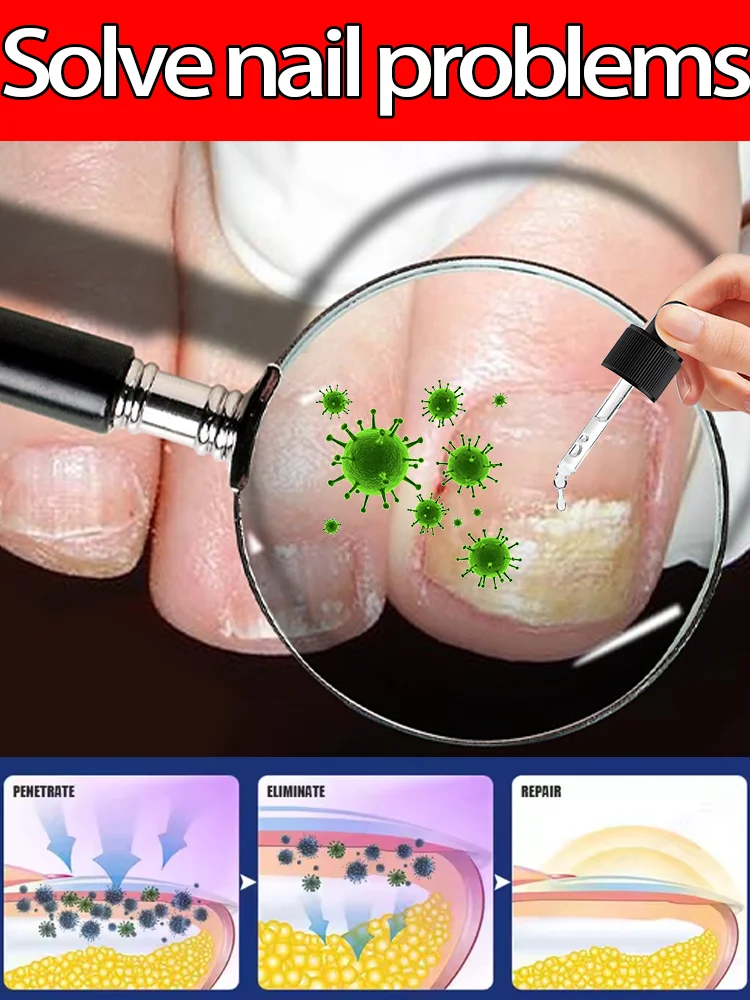 Sᴜᴍᴍᴇʀ's sᴇᴄʀᴇᴛ ᴡᴇᴀᴘᴏɴ ᴍᴀᴋᴇs ʏᴏᴜʀ ғᴇᴇᴛ ʙᴇᴀᴜᴛɪғᴜʟ ᴀɴᴅ ʏᴏᴜʀ ᴛʀᴏᴜʙʟᴇs ᴅɪsᴀᴘ