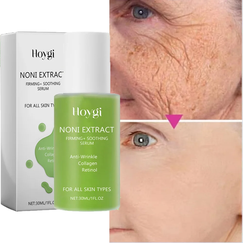 Noni Fruit Serum Noni Extract Energy Ampoule Face Product Korean Anti-wrinkle Moisturizing Sooth Wrinkles Fine Line For All Skin