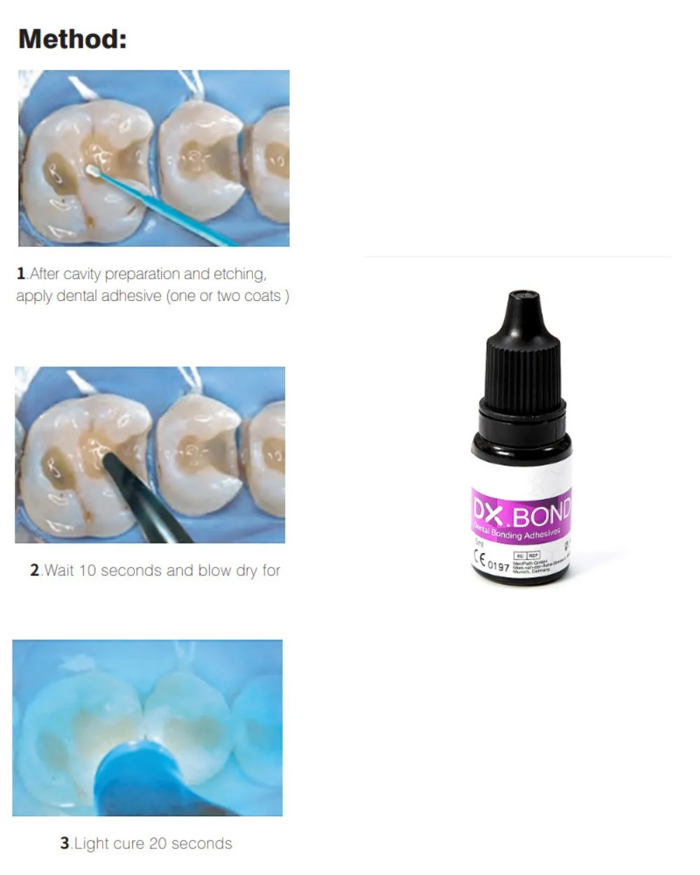 5 boxes  DX.BOND V Dental Bonding Adhesives Manual Power Source for Light Curing & Acid Etching Gel