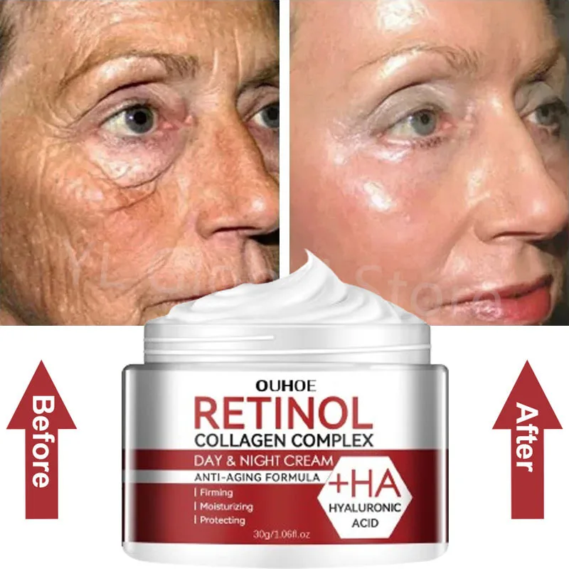 

Retinol Face Moisturizer Moisturizing Retinol Cream Anti-Wrinkle Aging Moisturizing Shrink Pores Whitening Smooth Retinol