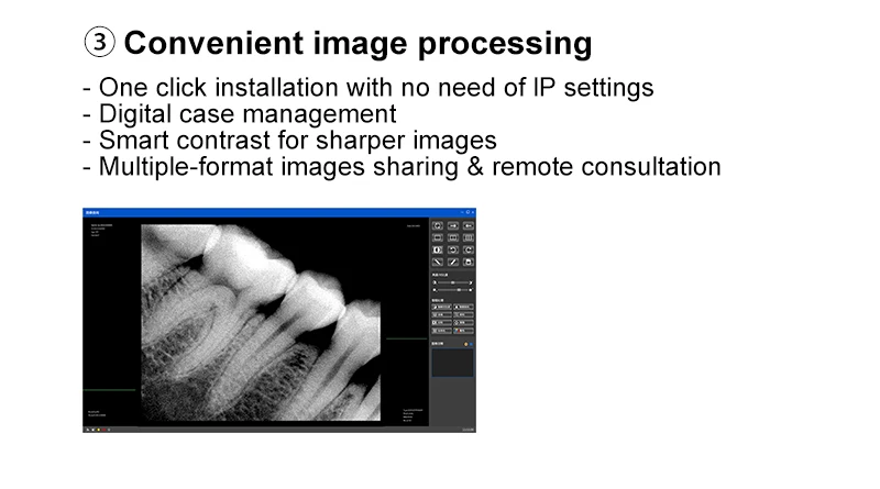 Tragbarer Dental-Röntgensensor Hochfrequenz-Rx Digitales Intraorales Digitalsystem Bildgebungs-Dentalwerkzeug Superschneller Sensor VVDental – Detail 6