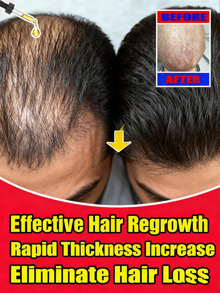 

Revitalize thinning hair with our potent essential oil blend—nourish follicles, boost growth, and embrace fuller, thicker locks