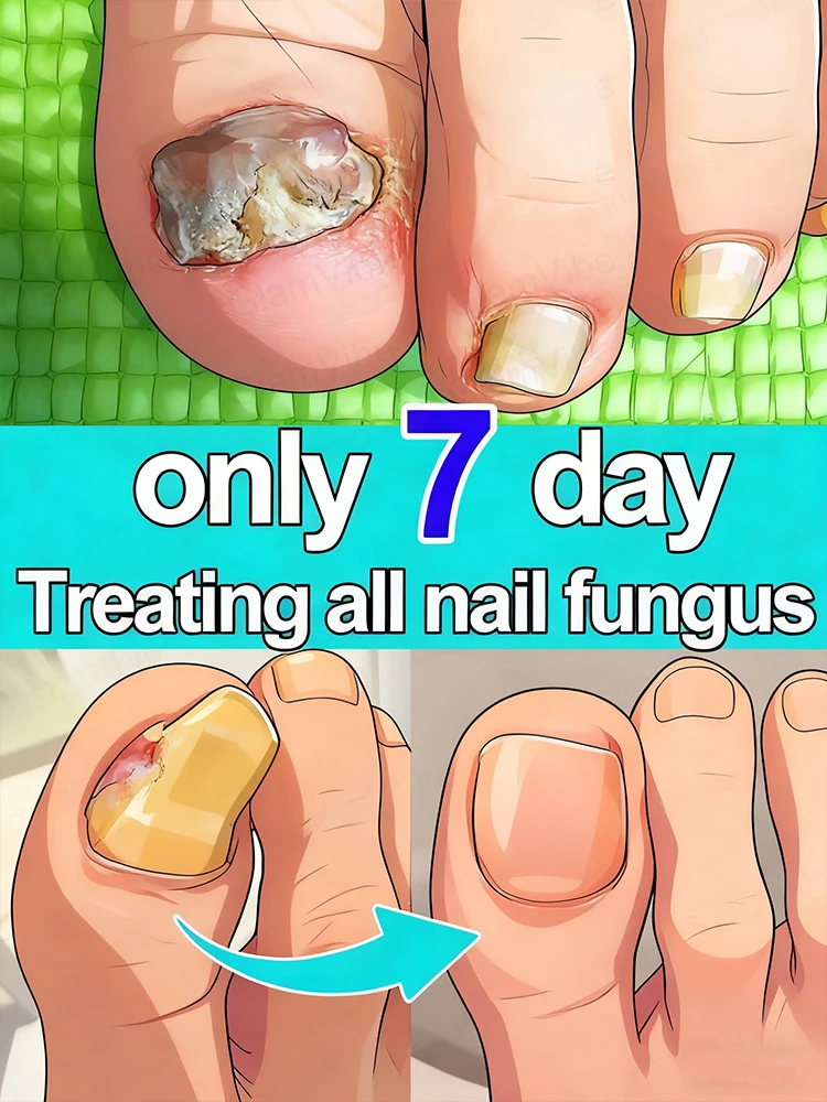 

Nail fungus treatment for 7 days