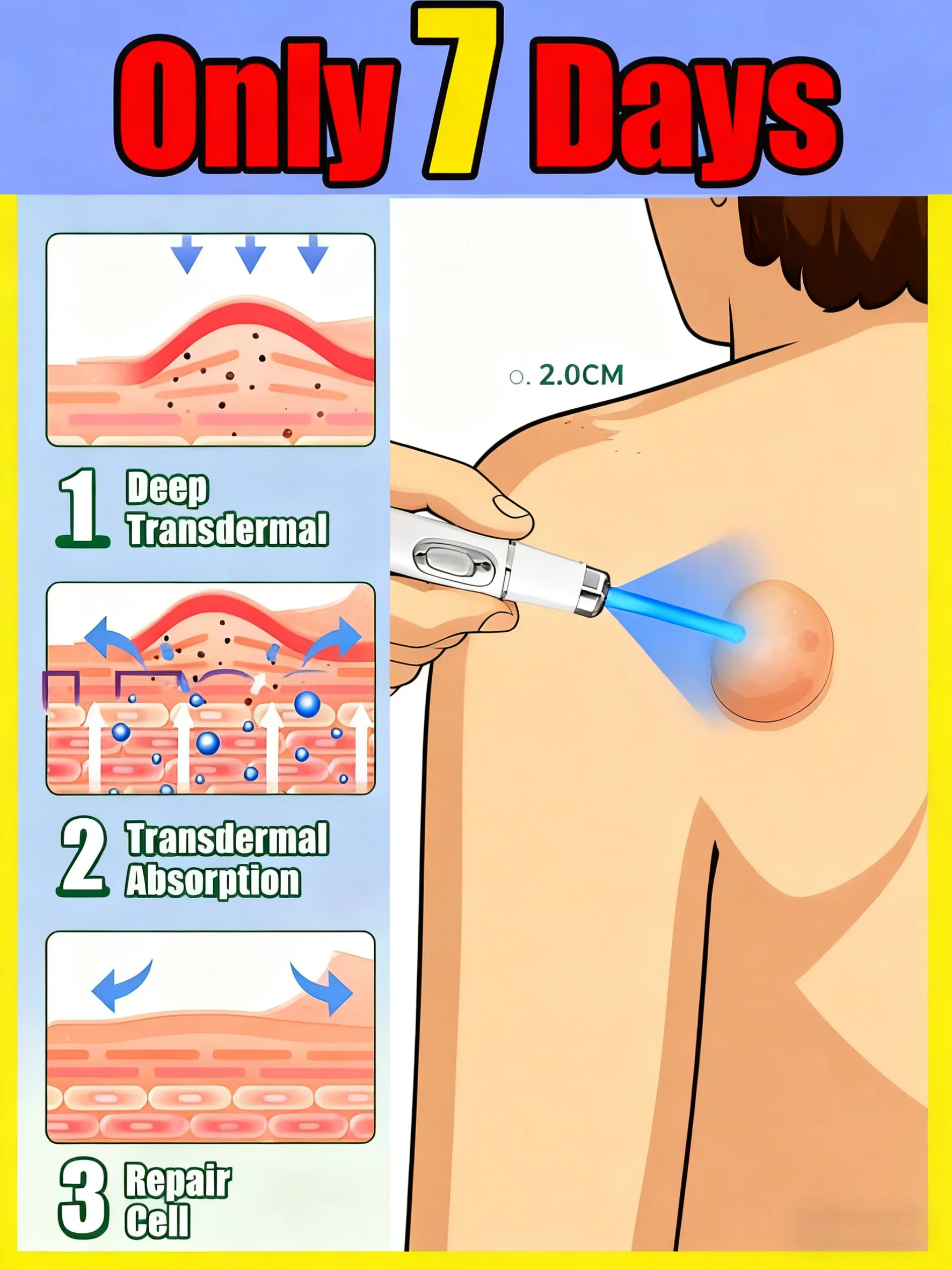 

unisx The blue laser pen gently cares for every inch of your skin, serving skin steward providing you a comfortable experience