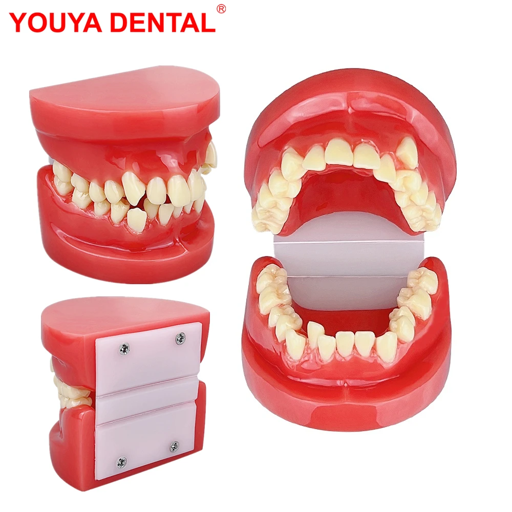 

1pcs Dental Model Teeth Malocclusion Model Dentistry Typodont For Teaching Education Demostration Dentist Students Studying Jaws