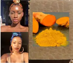 Skin Lightening ,Dark Spots, Skin Glow, Brighter Skin, Acne Scars, Turmeric Soap