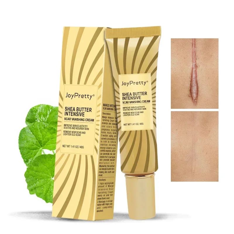 Scar Removal Cream Gel Remove Acne Spots Treatment Stretch Marks Burn Surgical Scar Repair ointment for Whitening Skin Beauty