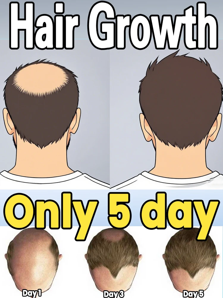 

Для решения проблем с волосами и защиты здоровья кожи головы, питайте корни волос, чтобы получить здоровые, шелковистые и объемные волосы.