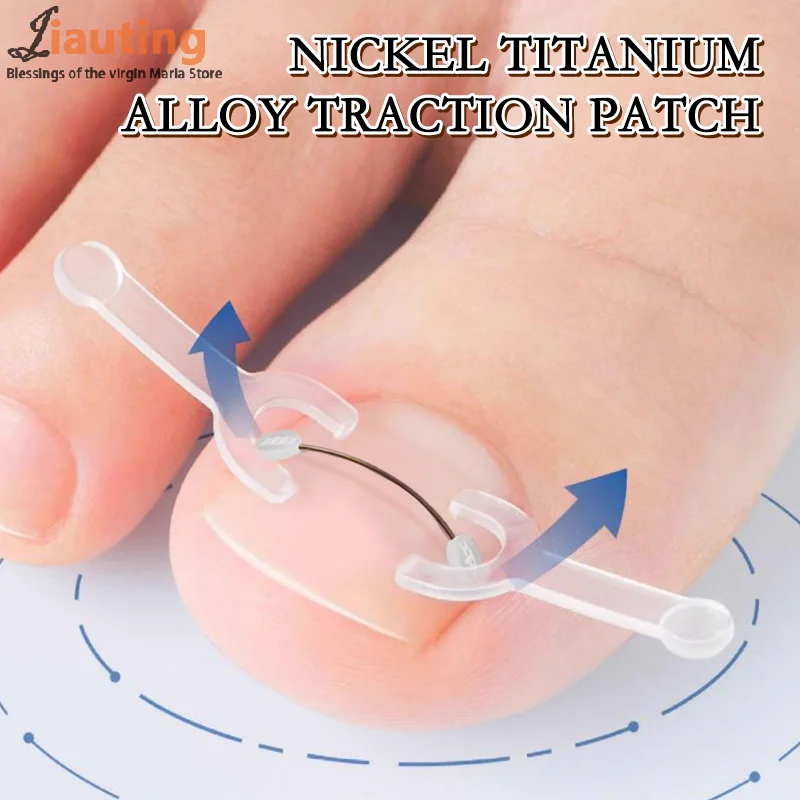 Hot Sale Ingrown Toenail Correction Tool Ingrown Toe Nail Treatment Elastic Patch Sticker Straightening Clip Brace Pedicure Tool
