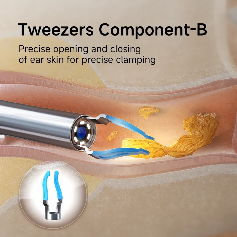 Bebird EarSight Plus Ear Tips Replacement Accessory Set - Image 5