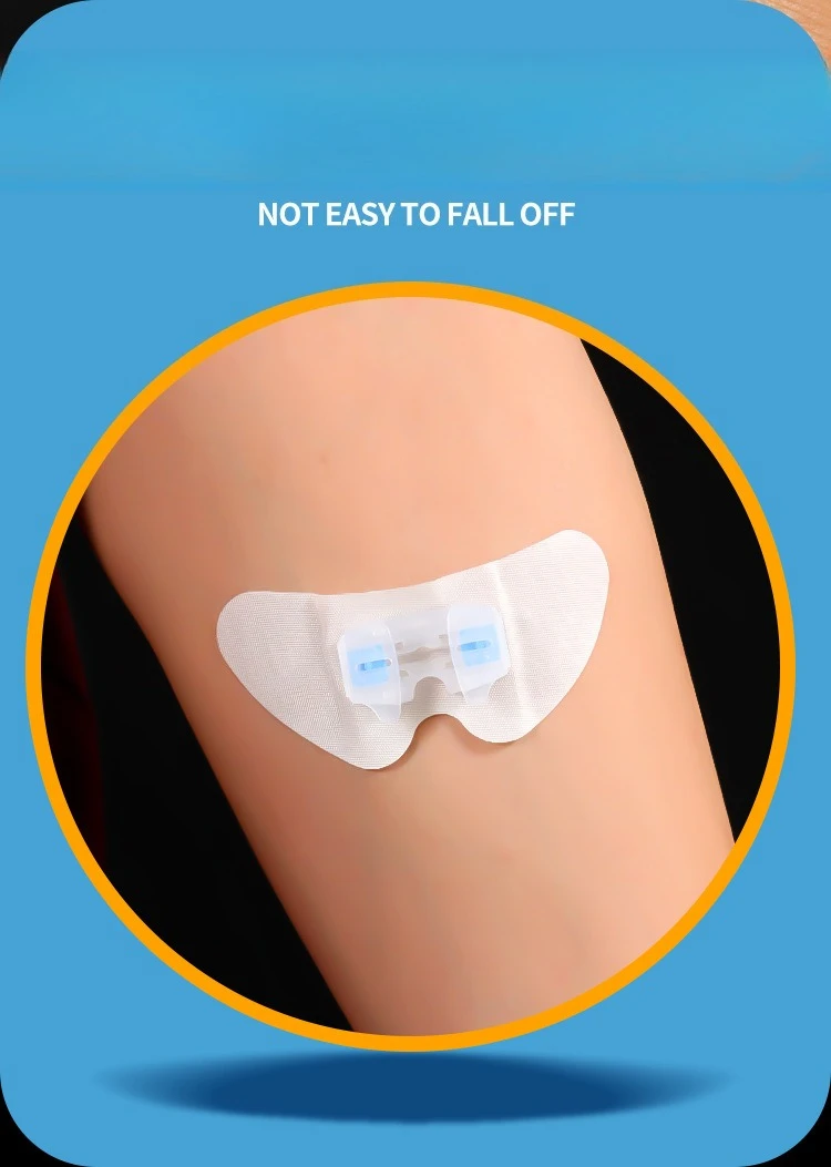 PICC Catheter Fixing Sticker Bile Drainage Tube Surface Fixation Device Butterfly Buckle Secure Stable Medical Skin Care Tool