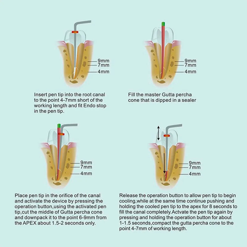 ELIJAH-Bolígrafo de obturación de gutapercha, odontología, 2 puntas, sistema de llenado de conducto radicular, herramienta de endodoncia Dental de calentamiento rápido de 3 segundos