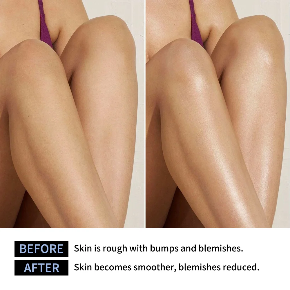 Lakerain Exfoliating Body Stick Multiple Glycolic Acid Cleaning Long-lasting Moisturizing Nourishing Smoothing Skin Care image 4