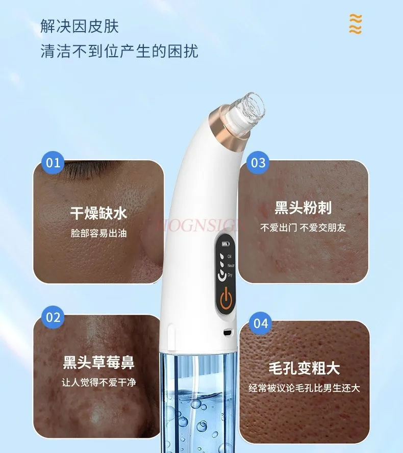 Visual blackhead aspirator, acne removal pore cleaner, electric small bubble blackhead aspirator