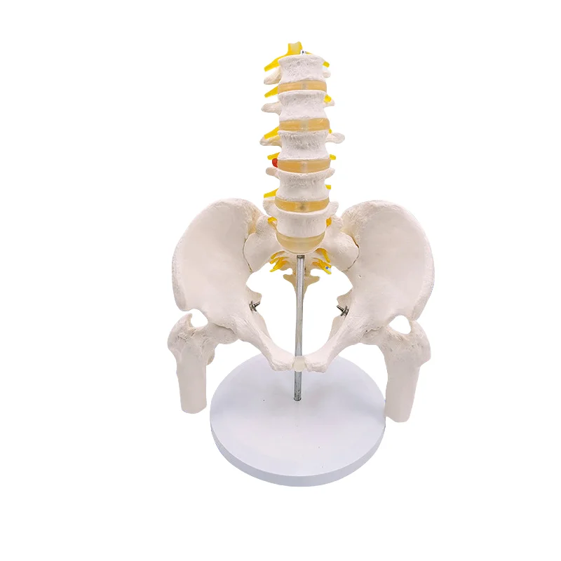 

5-секционный поясничный отдел позвоночника с тазом и сломанной костью ноги, прикрепленная модель человеческого скелета нерва 24*20*30 см