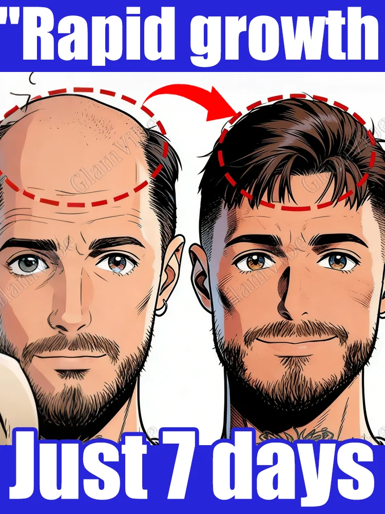 

Rᴇᴠɪᴛᴀʟɪᴢɪɴɢ ʜᴀɪʀ sᴘʀᴀʏ Revitalizes hair follicles, making you the center ᴏғ ᴀᴛᴛᴇɴᴛɪᴏɴ