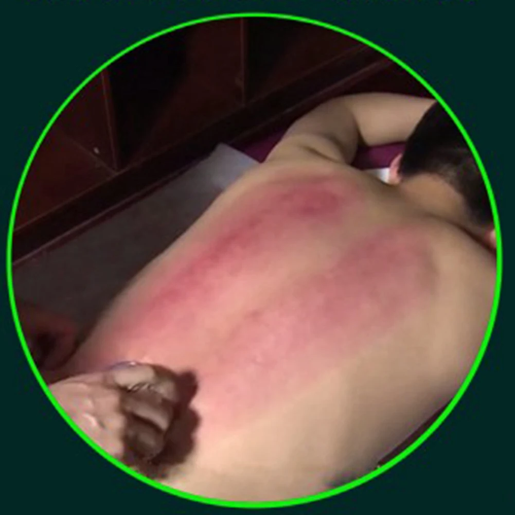 

AA49 Синие вакуумные банки, массажные силиконовые банки, поглотитель влаги, 8 шт.