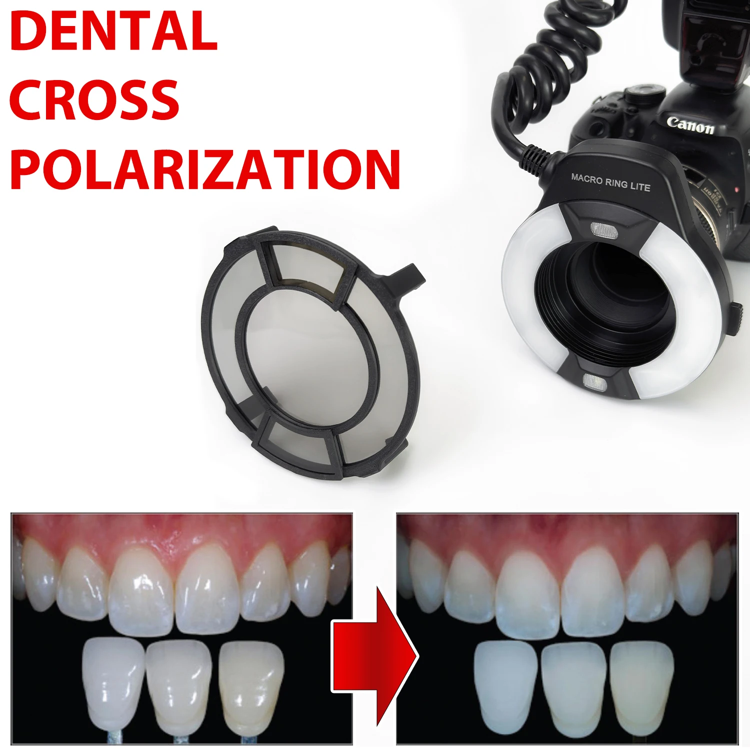 Filtro de Lente Polarizadora Cruzada para Fotografia Dentária – sem Brilho sem Relfeção Fotos de Olhos Polar para Dentista para Flasheike