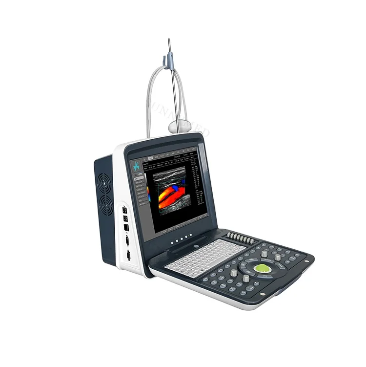 SYA-P8106 Portable 30dB-75dB Color Doppler color portable siterite vascular ultrasound