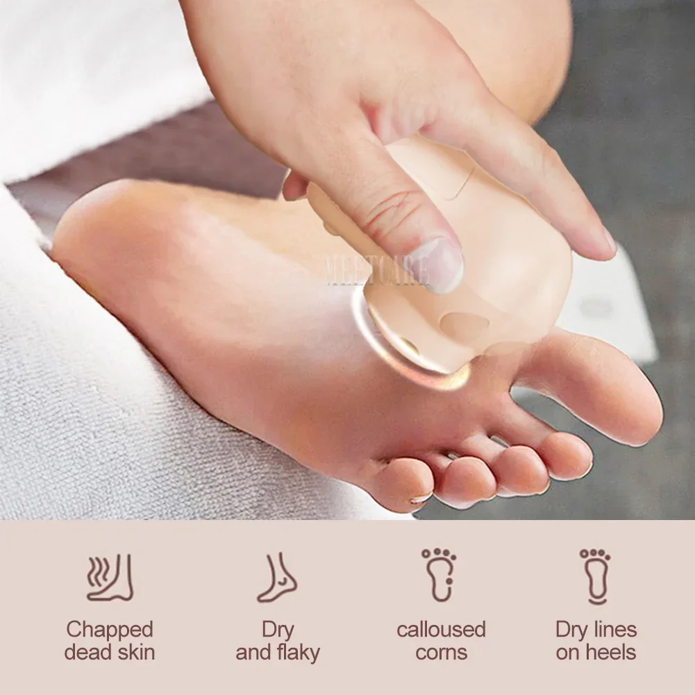 Mini Electric Pedicure Foot Grinder with LED Dry Peel USB Charging 3 Grinding Wheel Waterproof Foot Exfoliating Calluses Tool