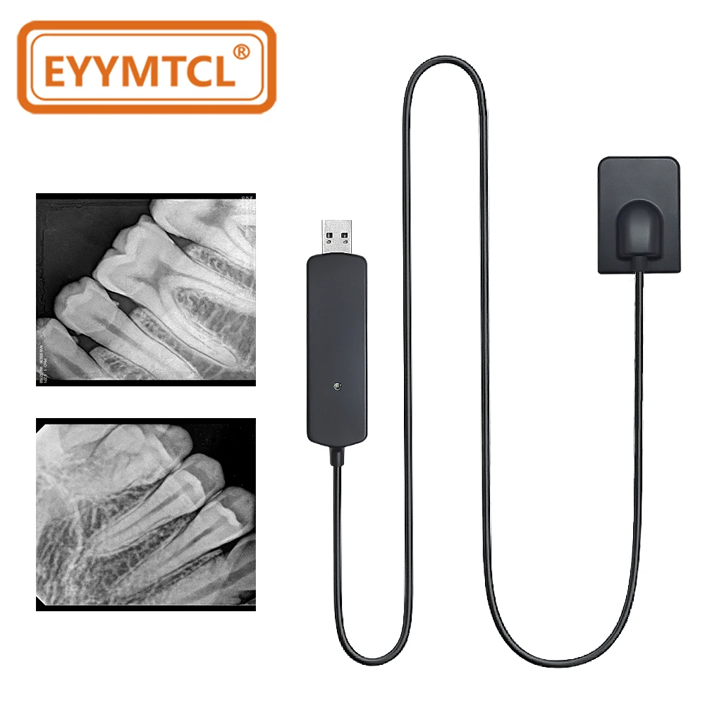 

EYY Стоматологический цифровой рентгеновский датчик Радиовизиограф Система внутриротовой визуализации Rx Внутриротовой HD-датчик изображения Стоматологическая клиника Датчик полости рта