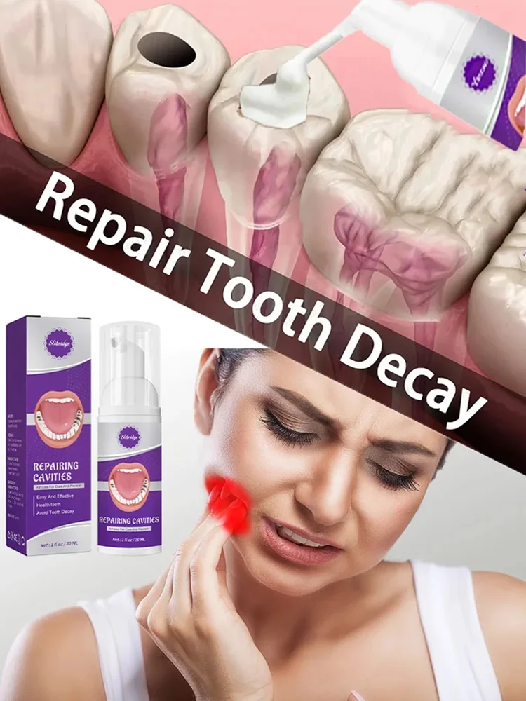 

Tooth Decay Repair Decay Cavities Anti Caries