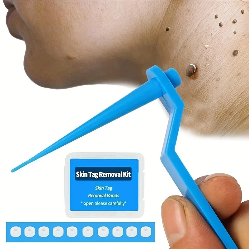 1 Set Skin Tag Removal Kit Skin Mole Wart Remover Micro Band Skin Tag Removal Kit Tag Treatment Tools Set with Cleansing Swabs