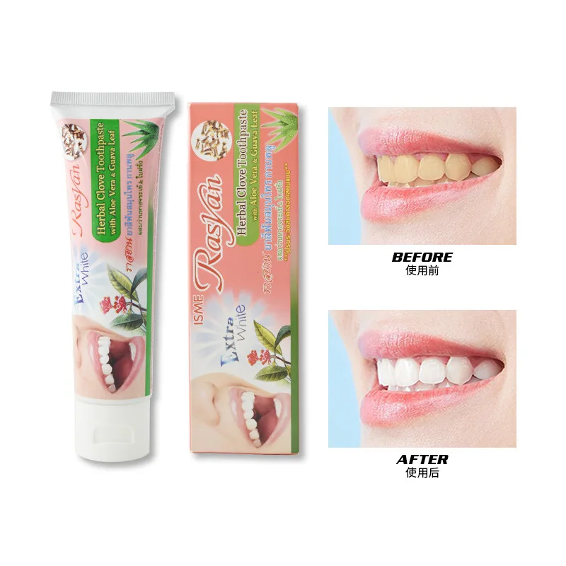 

Toothpaste Whitening Yellowing Bad Breath Tartar Calculus Fresh Breath