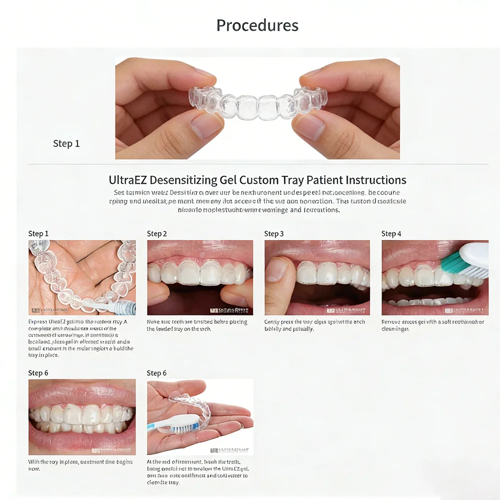 Ultra Ez Dental Desensitizing  - đánh giá và giá Teeth Whitening Opalescence