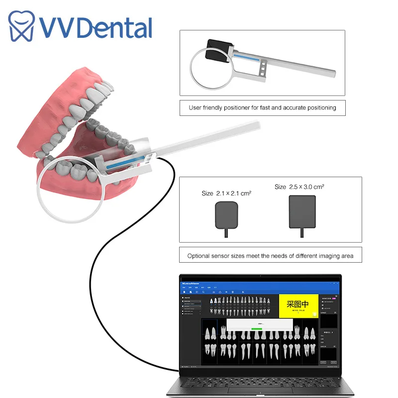 

Dental X Ray Sensor Digital HDR Frequency Imaging System RVG Digital Sensor Medical Equipment Intraoral System Image Sensor