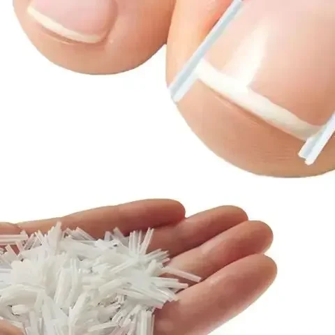 50 pçs dedo do pé encravado tratamento de unhas remendo elástico adesivo alisamento clipe encravado ferramenta correção cinta pedicure ferramenta