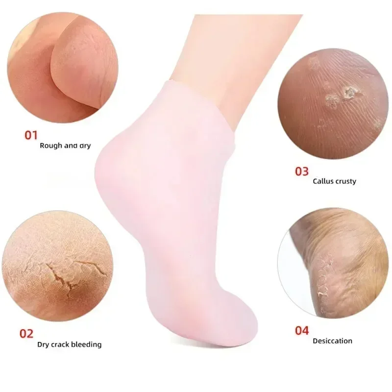 1 Pair Silicone Moisturizing Socks Exfoliating Gel Heel Socks Callus Cracked Dead Skin Remove Protector Pain Relief Foot Care