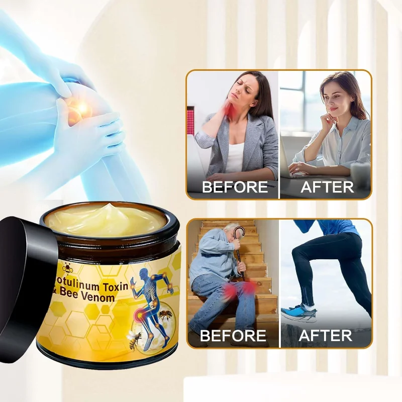 2PCS Botulinum Toxin & Bee Venom, Bee Venom Bone Cream, Bee Venom Joint Gel, Professionelle Bee Venom Joint & Bone Cream, Bee Venom
