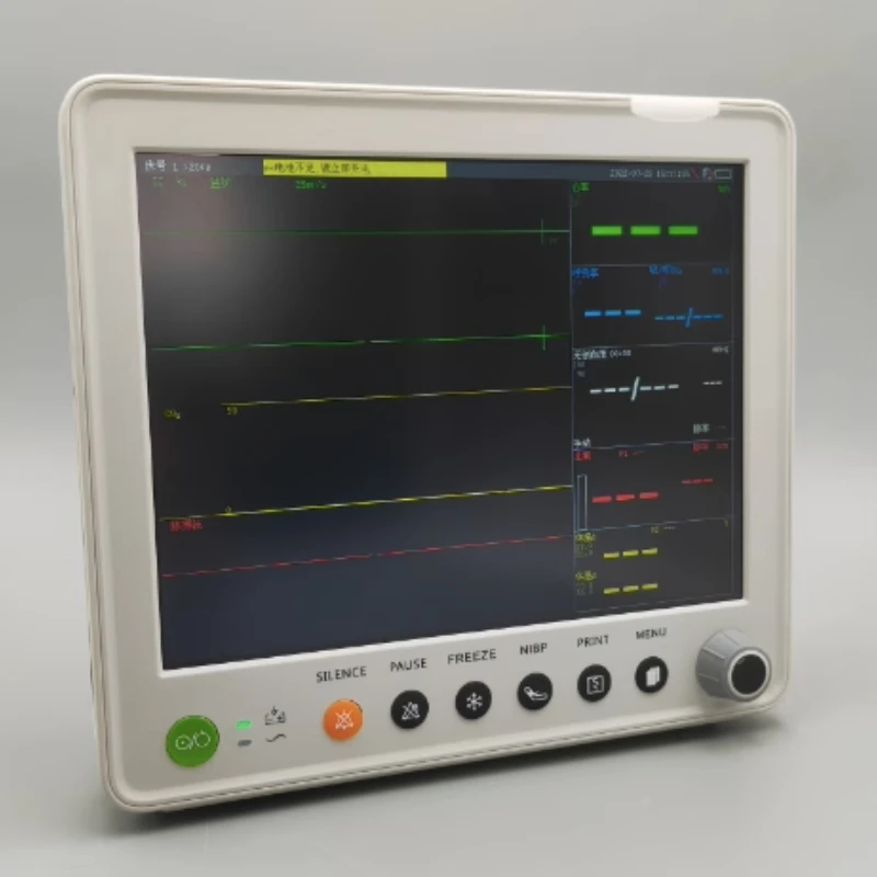 

12-Inch veterinary animal multi-parameter detector for pet hospital pet multi-function portable monitor