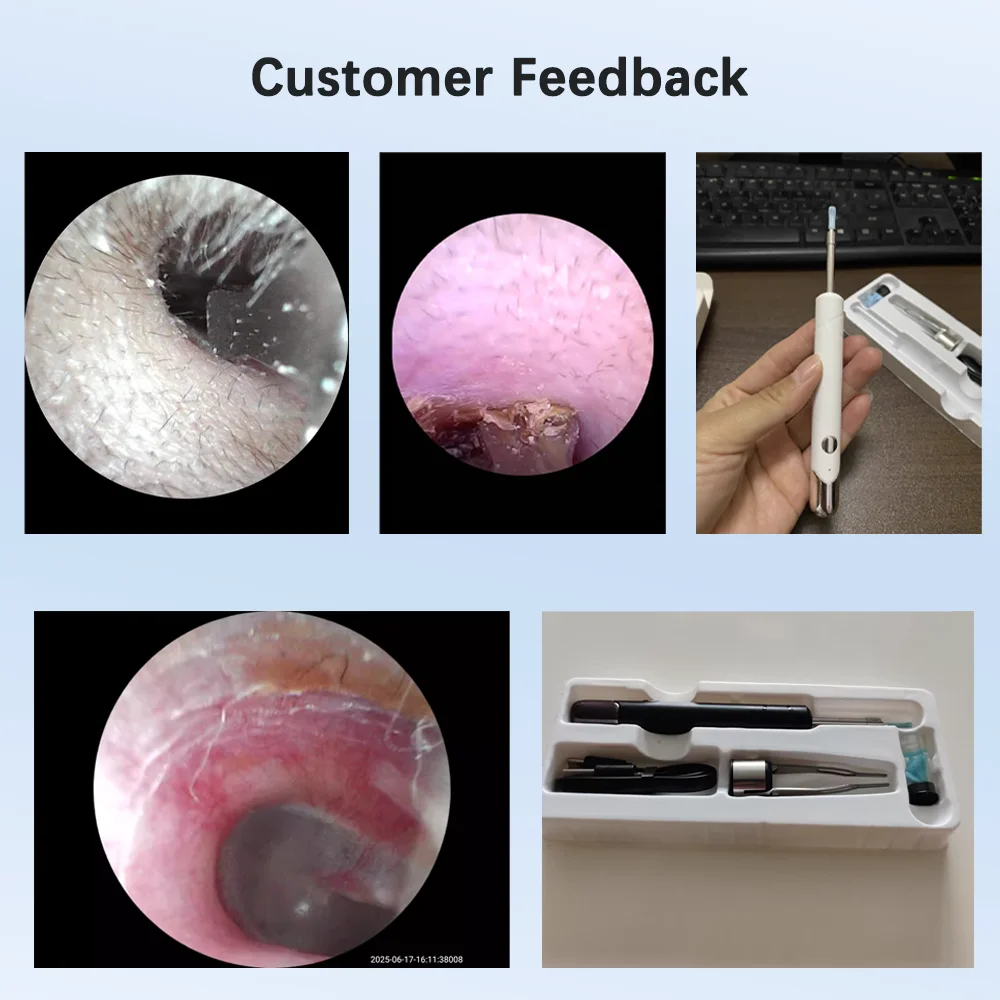 Dodosee 2300P HD Visual Ear Cleaner con fotocamera Strumento per la rimozione del cerume con pinzette Otoscopio Ear Pick Rimuovi lo sporco dell'orecchio Assistenza sanitaria