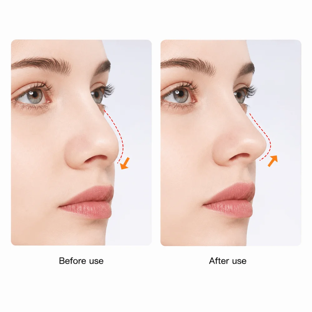 EMS Micro Current Nose Shaper Device Electric Clip Frame Pulse Mode Nose Massage Gear Raise Nose Bridge Refine Nose Wing
