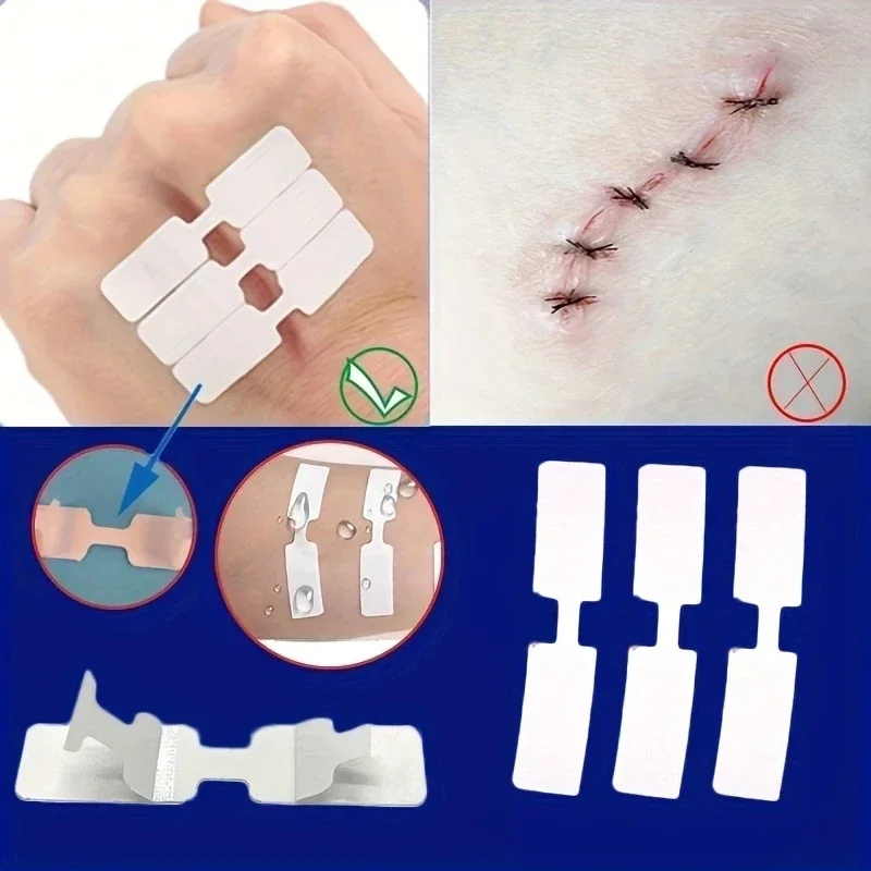 5Pcs Emergency Wound Closure Tape Breathable Portable Outdoor First Aid Adhesive Suture Strips for Quick Wound Repair & Bandage