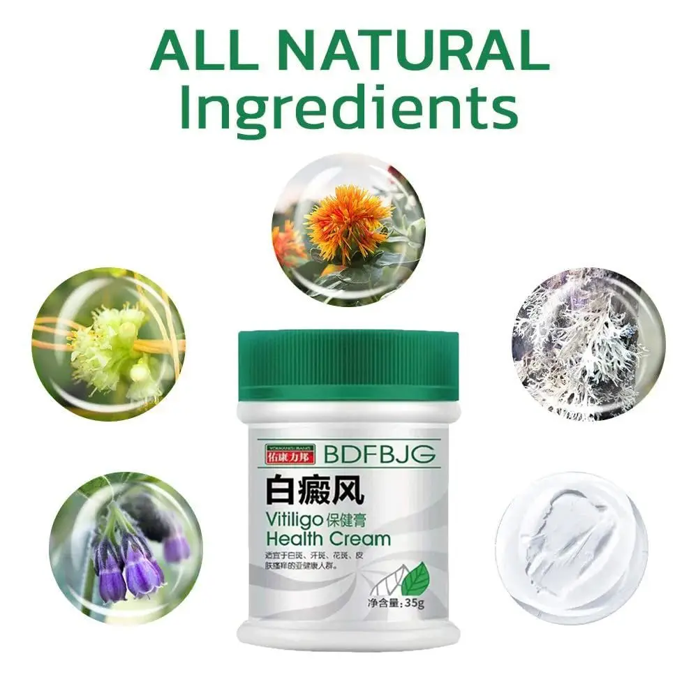 Natural TreatVitiligo Soothing Cream Skin Care Improve Skin Discoloration Vitiligo Care Cream Fast Penetration Moisturizes