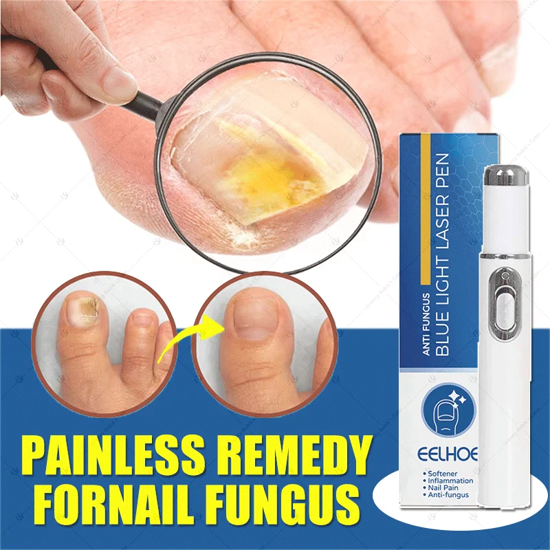 

laser for nails with fungus