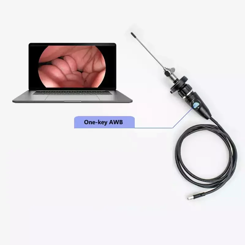 

USB3.0 Full HD Portable Handle Ent Endoscope for Nasal Otoscope