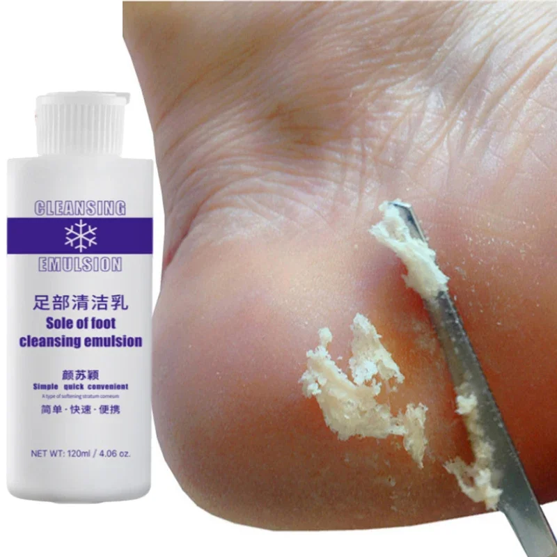 Adoucisseur exfoliant pour les pieds, 120ml et acier inoxydable, coupe-ongles, ensemble de ciseaux, élimine les callosités de la peau morte, Kit de pédicure, 4 pièces