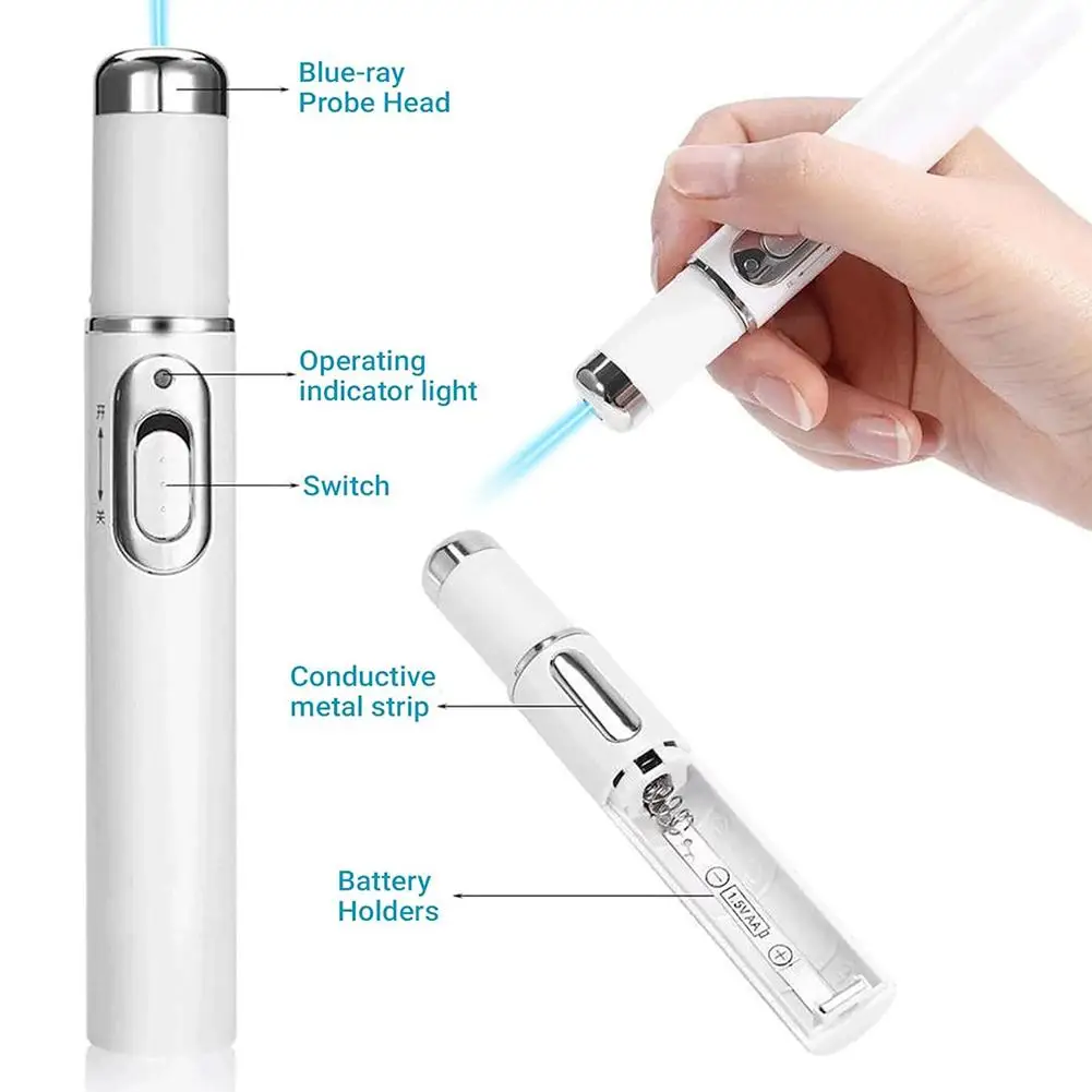 Blue Light Pen Eye Massager Eye Massage Instrument Dark Circles Eye Bag Puffiness Under Eye And 4 Styles Moisturizing Eye Cream