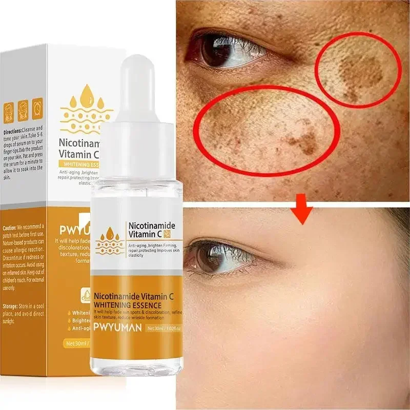 Nicotinamide Whitening Freckles Serum Dark Spot Removal Vitamin C Lightening Melanin Acne Scars Moisturizing Brighten Face Care