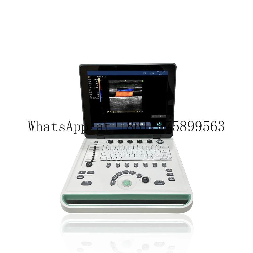 15 Inch Laptop Portable Ult ra sound Scanner Machine Color Dop pler USG Linear Convex Probe Clinic Veterinary