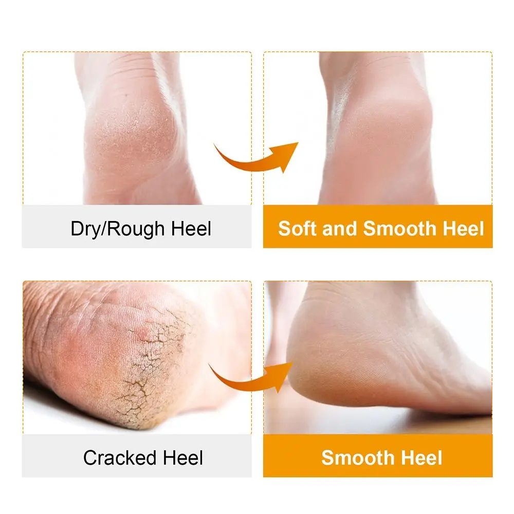 2 Pcs/Set Washable Silicone Open Toe Socks Relieve Dry Cracked Non-slip Foot Care Protector Breathable Shoes Insole Women