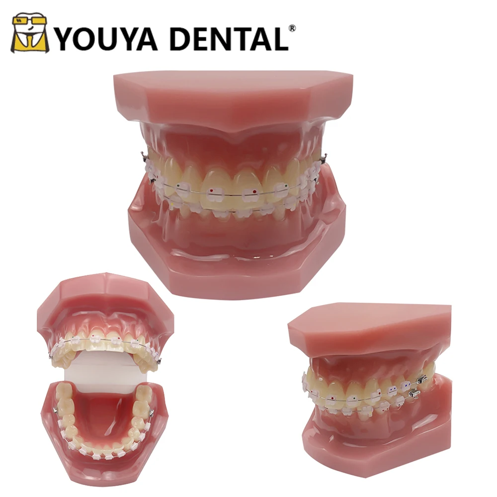Dental Orthodontic Teeth Teaching Model for Dental Technician Practice Training Studying Orthodontic Model
