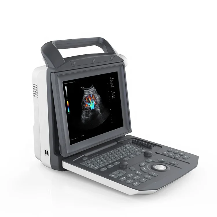 CU45 Echografie Draagbare Laptop Doppler Ultrasound Scanner