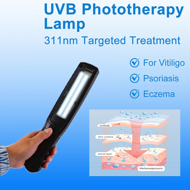 

UVB Lamp UV for Vitiligo Psoriasis White Spots Skin Disease