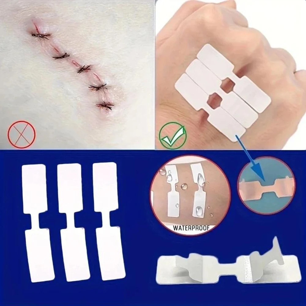 

50/100PCS Outdoor Wound Adhesive Tape Disposable First Aid Wound Suture Patch Wound Emergency Quick Suture Patch